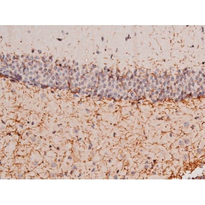 STAT3 Antibody (phospho-Tyr705)