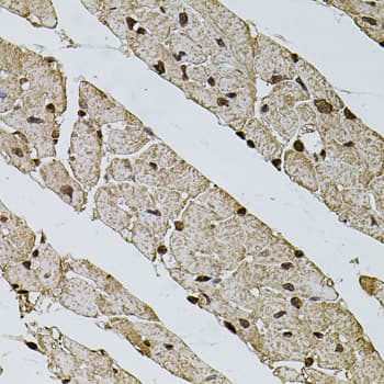 PHF1 Antibody