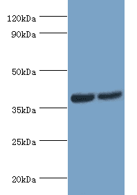ATP6AP2 / Renin Receptor Antibody (aa251-350)