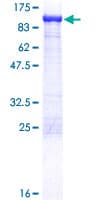 Human ACO2 / Aconitase 2 Protein (Recombinant GST)