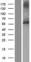 FPGS Protein (Over-Expression Lysate Myc-DDK (Flag))
