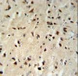 Polyclonal Rabbit anti-Human FKBP1B / FKBP12.6 Antibody (aa16-46, IHC, IF, WB)