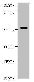 STARD3 / MLN64 Antibody (aa170-445)