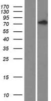 Human C1orf168 Protein (Over-Expression Lysate Myc-DDK (Flag))