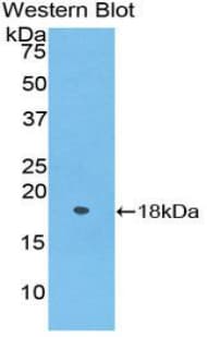 POSTN / Periostin Antibody (aa24-173, Biotin)