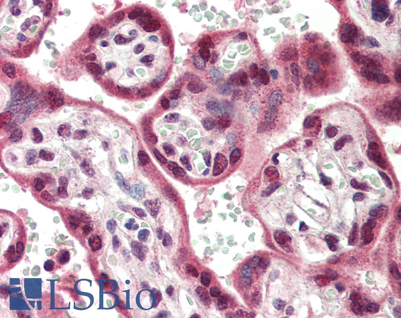IHC-plus™ BCL2L13 / Bcl Rambo Antibody
