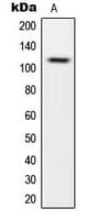 CARD14 Antibody (Internal)