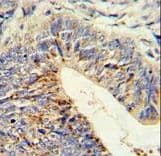 ADAMDEC1 Antibody (aa39-69)