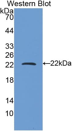 FTH1 / Ferritin Heavy Chain Antibody (aa1-171)