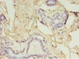 Polyclonal Rabbit anti-Human GGPS1 Antibody (HRP, aa1-300, IHC)