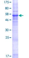 Human WBSCR28 Protein (Recombinant GST)