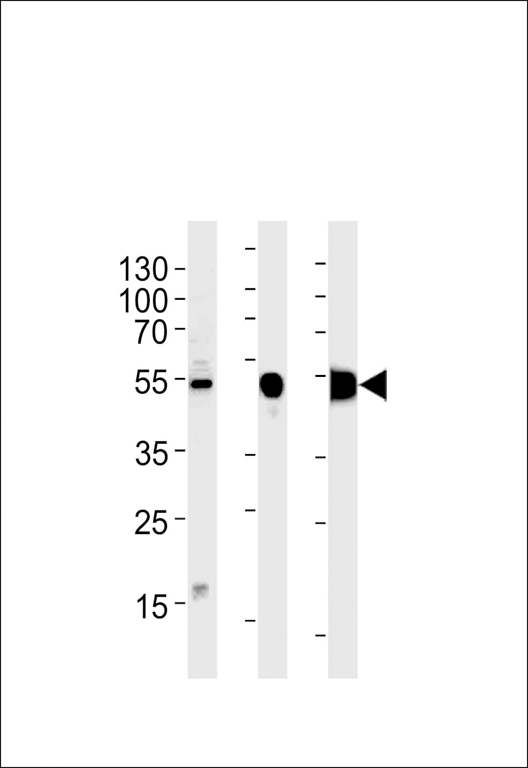 ENO3 / Enolase 3 Antibody (aa237-264)
