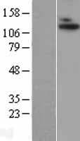 ADAMTS10 Protein (Over-Expression Lysate Myc-DDK (Flag))