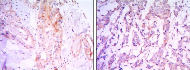 RICTOR Antibody (clone 7B3)