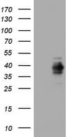 MKI67 / Ki67 Antibody (aa1160-1493, clone OTI2B4)