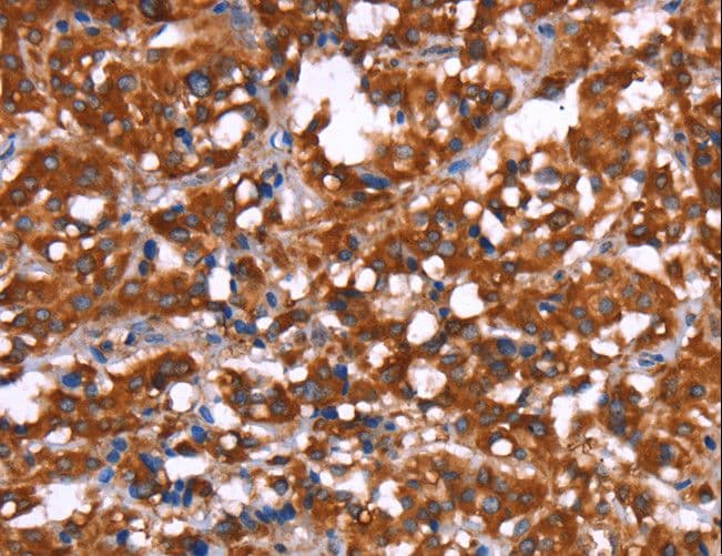 Polyclonal Rabbit anti-Human GAGE12I / GAGE7B Antibody (IHC)