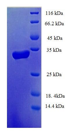 Human DTD2 Protein (Recombinant His-SUMO)