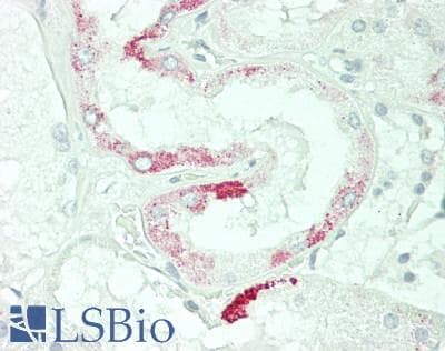 IHC-plus™ ARG2 / Arginase 2 Antibody (clone 3G5)