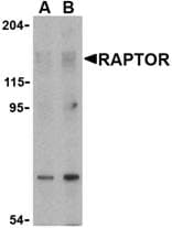 IHC-plus™ Raptor / Mip1 Antibody
