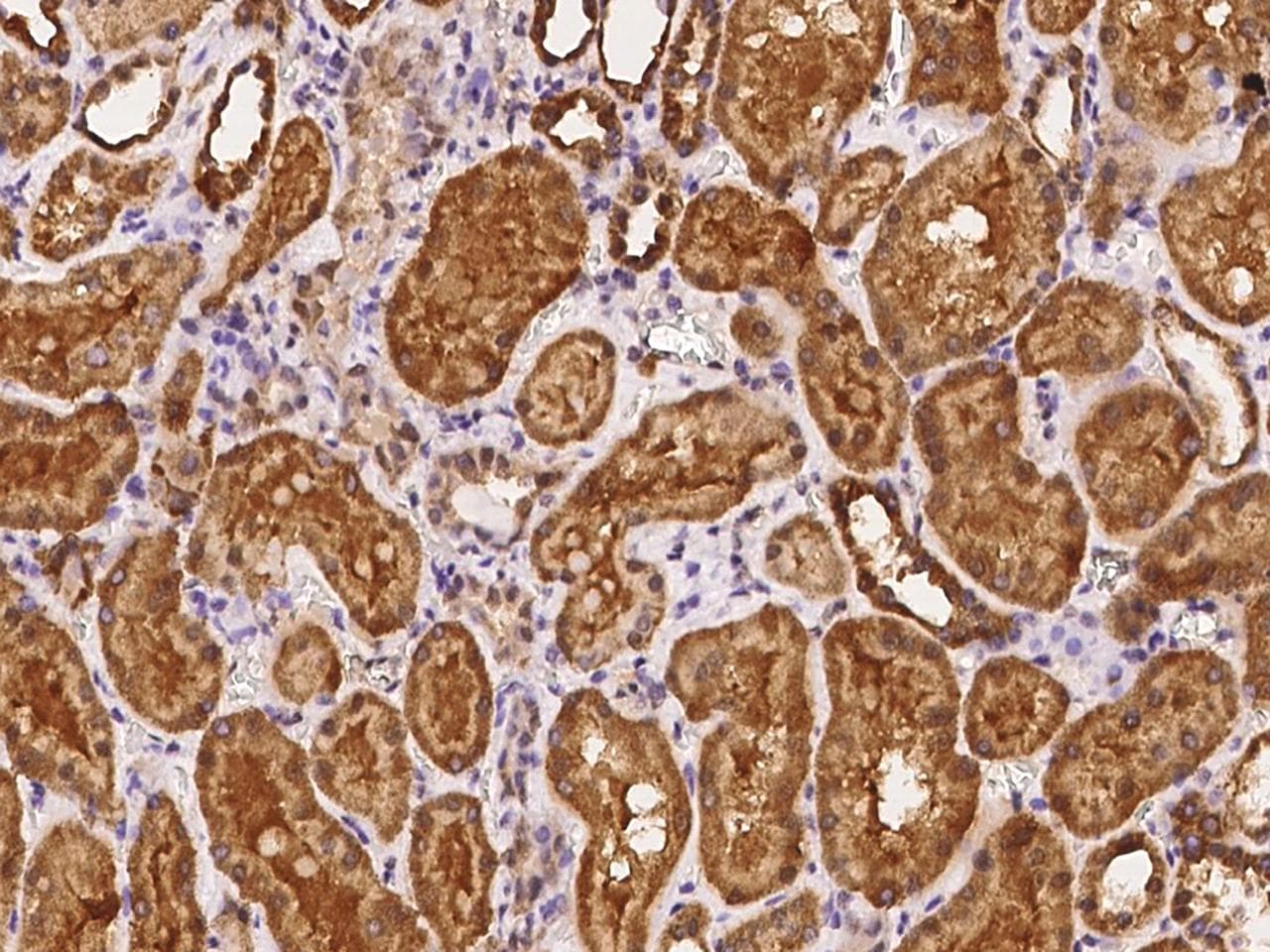 PGBD4 Antibody