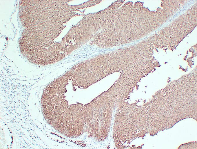 S100P Antibody (clone ABT-S100P)