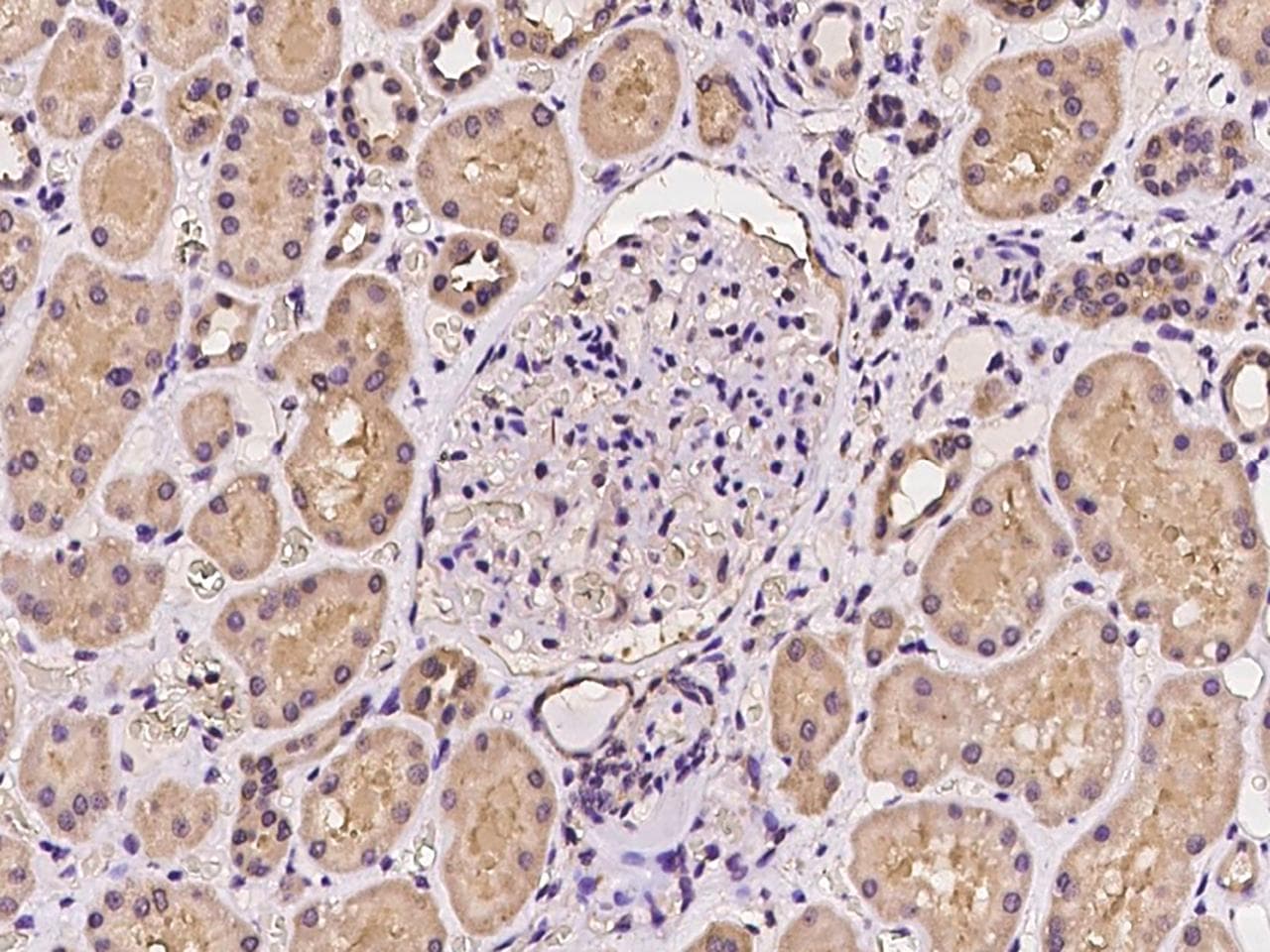 PRPSAP2 Antibody