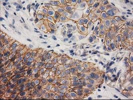 CTNNB1 / Beta Catenin Antibody (clone OTI12H7)