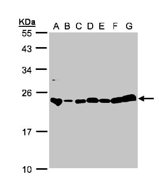 IHC-plus™ GLO1 / Glyoxalase I Antibody (aa1-184)