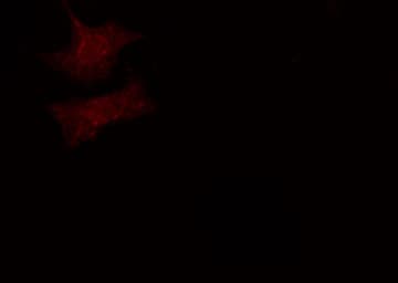 Polyclonal Rabbit anti-Human DVL3 / Dishevelled 3 Antibody (IHC, IF, WB)