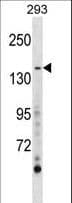 Polyclonal Rabbit anti-Human ACLP / AEBP1 Antibody (aa334-364, WB)