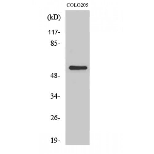 GRK7 / GPRK7 Antibody (340-420 aa, Internal)