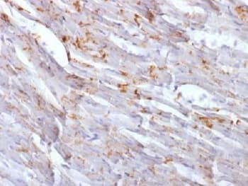 CDH2 / N Cadherin Antibody (clone CDH2/1573)
