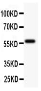 DNTT / TdT Antibody (aa316-509)