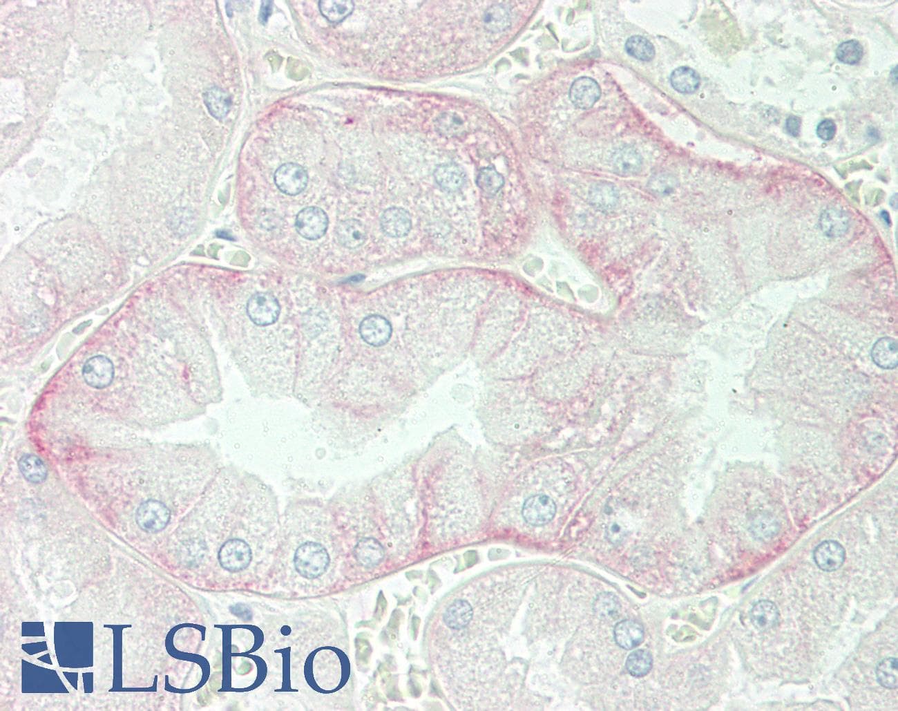 IHC-plus™ SLC3A2 / CD98 Heavy Chain Antibody (aa89-433)