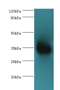 ARG1 / Arginase 1 Antibody (aa1-322)