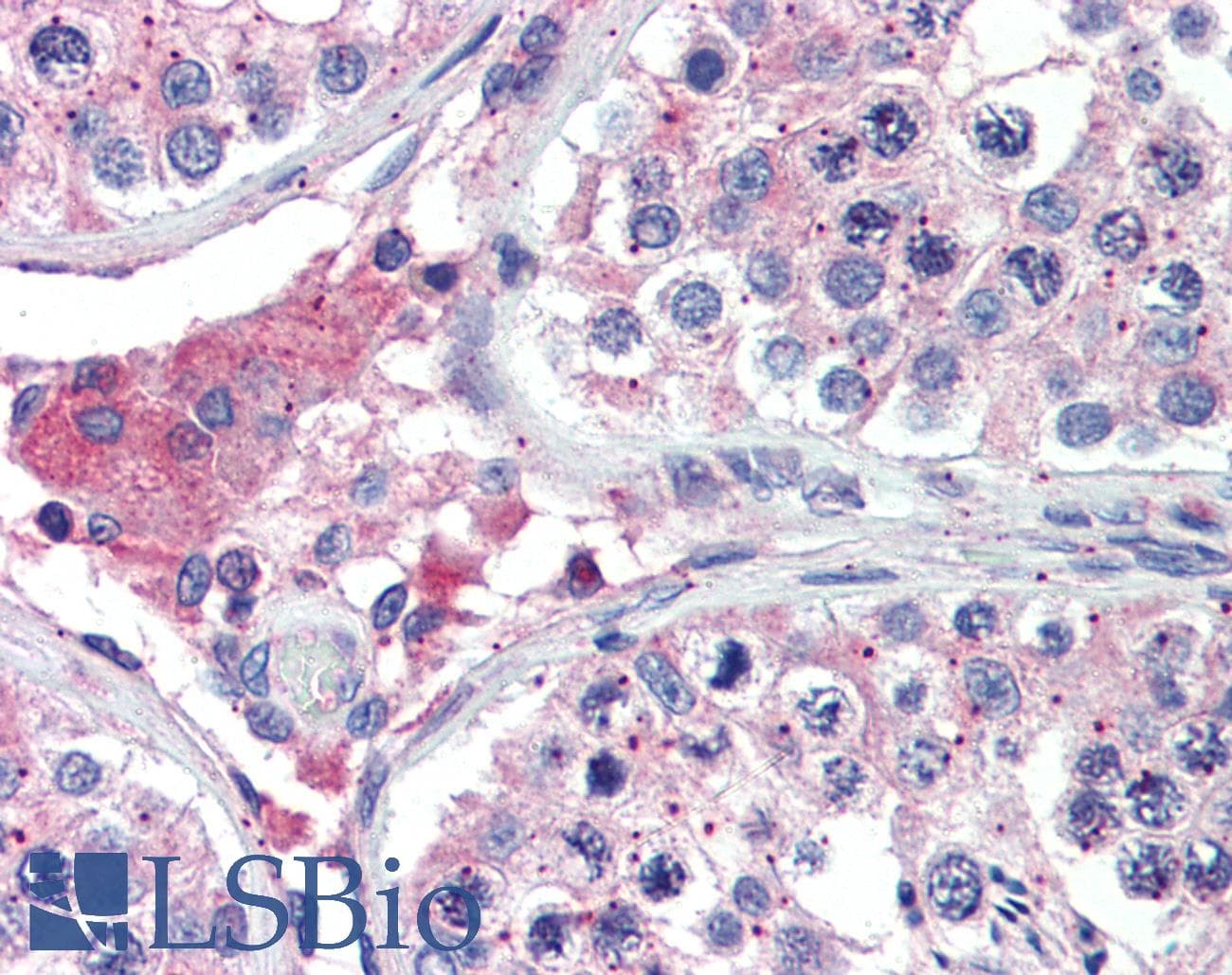 IHC-plus™ BACE2 Antibody