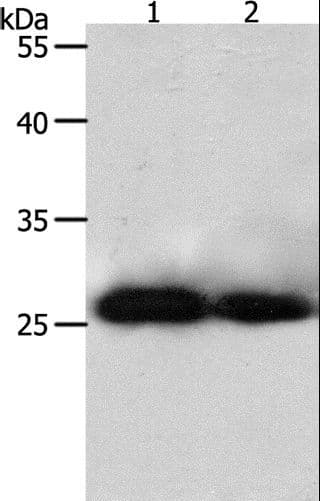 PRDX3 / Peroxiredoxin 3 Antibody
