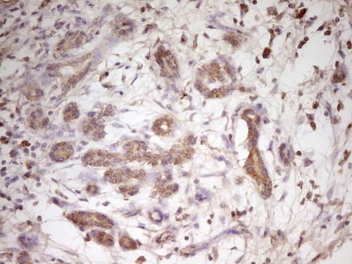 TRB3 / TRIB3 Antibody (aa1-200, clone OTI3F3)