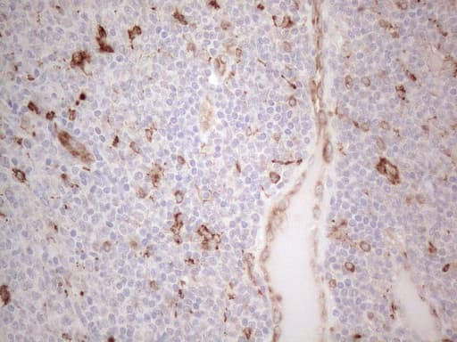 GRN / Granulin Antibody (aa327-593, clone OTI3B3)