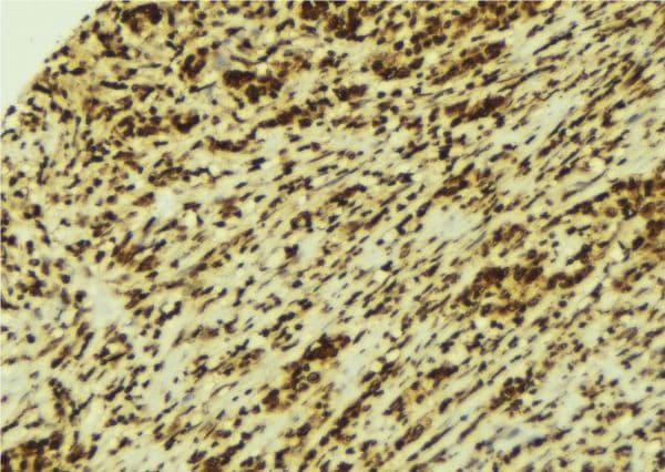 STAT4 Antibody