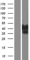 Human ATXN3 / JOS Protein (Over-Expression Lysate Myc-DDK (Flag))