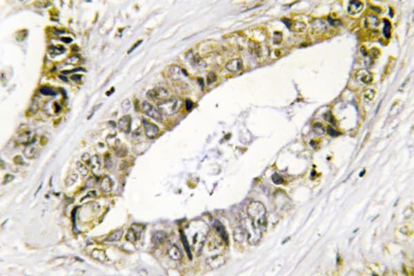 PRKAB1 / AMPK Beta 1 Antibody (His17)