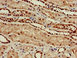 Polyclonal Rabbit anti-Human GUCD1 Antibody (IHC, IF, WB)