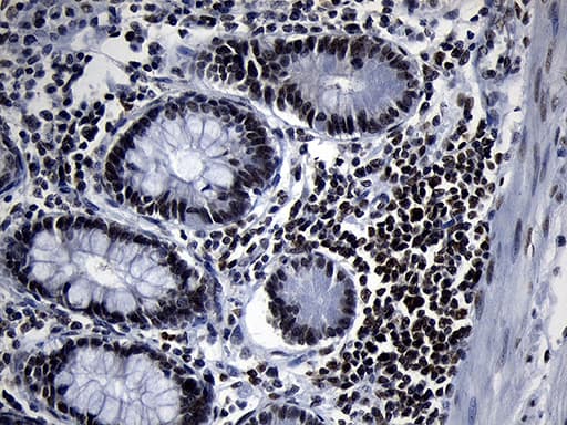 Monoclonal Mouse anti-Human ZHX2 / RAF Antibody (clone OTI2E11, Carrier-free, aa595-837, IHC, WB)