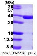 Human SULT2A1 / Sulfotransferase 2A1 Protein (Recombinant His)