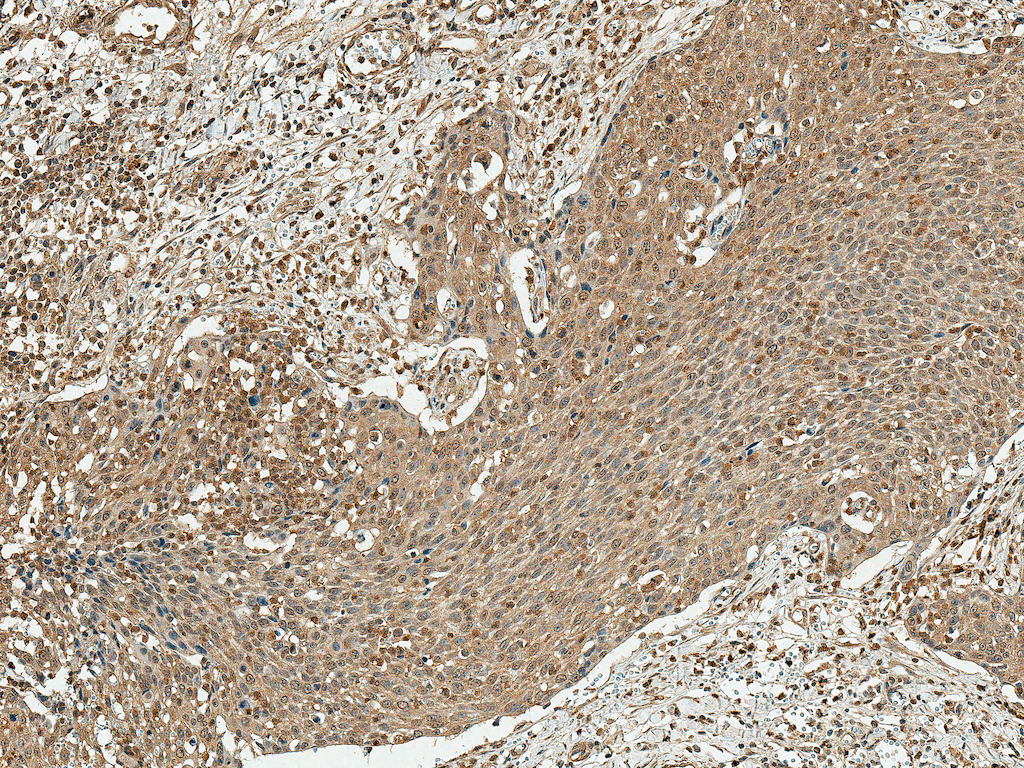CCND1 / Cyclin D1 Antibody