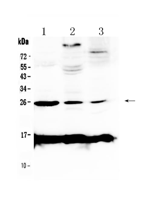 CRP / C-Reactive Protein Antibody