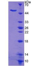 Human NUMA1 / NUMA Protein (Recombinant 6His, N-terminus)