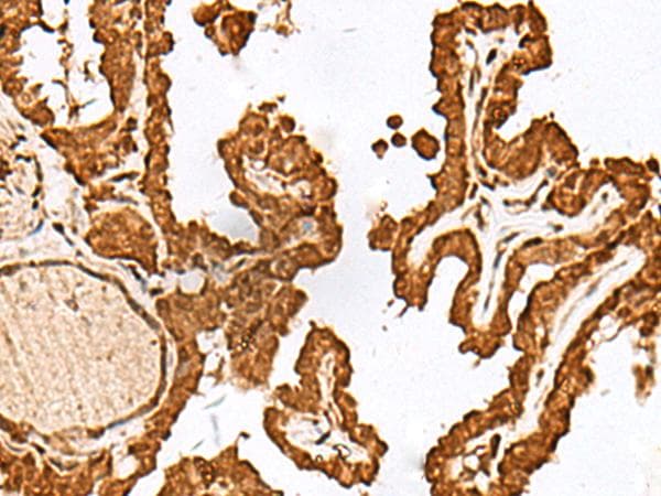 FAM50A Antibody