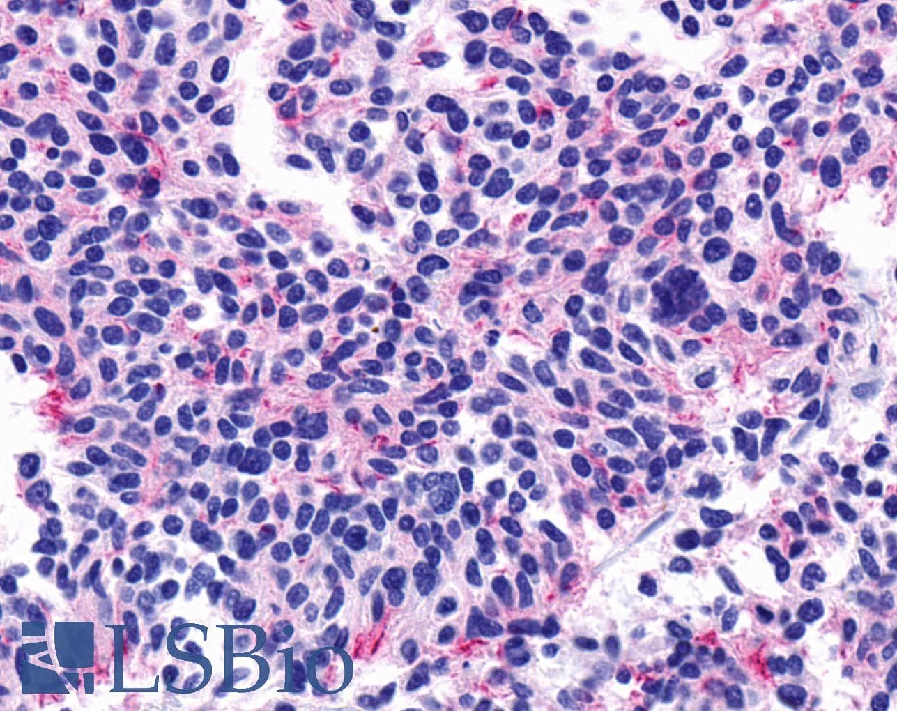 PathPlus™ CHRM5 / M5 Antibody (Cytoplasmic Domain)